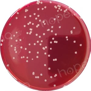 三株伯克霍尔德菌在含多粘菌素B、庆大霉素的BCSA琼脂平板上的菌落特征/
